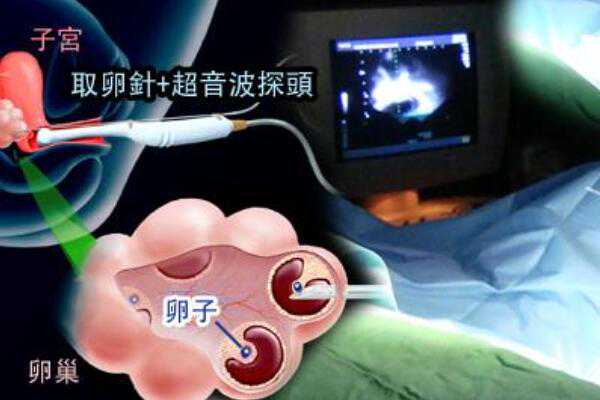 深圳寻找助孕母亲的医院,深圳十大试管医院成功率排名情况是怎么样的？