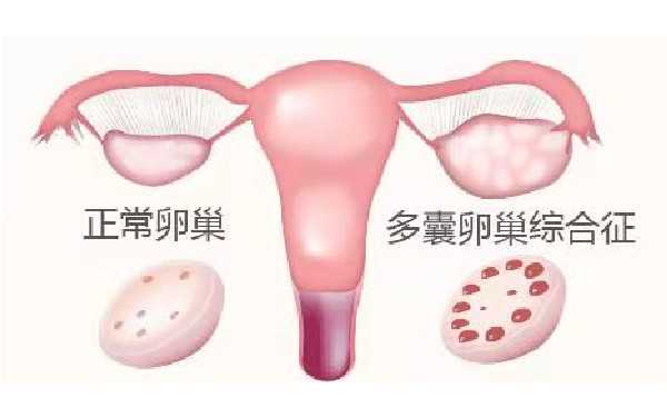 深圳有资质的代孕公司 深圳供卵试管婴儿攻略 ‘7周看看男孩女孩彩超单子’